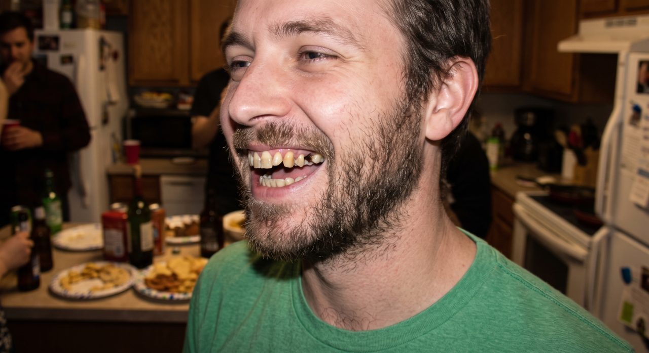 Foto de sonrisa del paciente antes y después de la simulación Sonrisa Perfecta — Antes